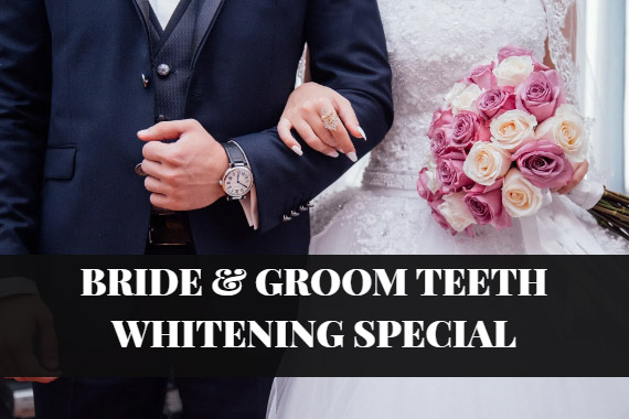 Wedding Teeth Whitening Specials | iSmile Spas in Buffalo, NY